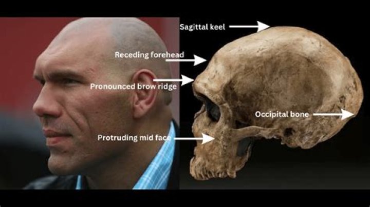 Why does Emile have skull?