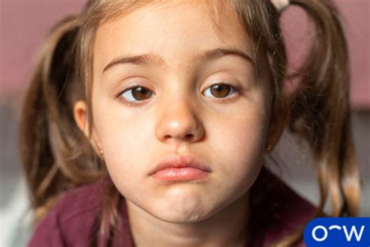 Why does my 4 year old go cross eyed?