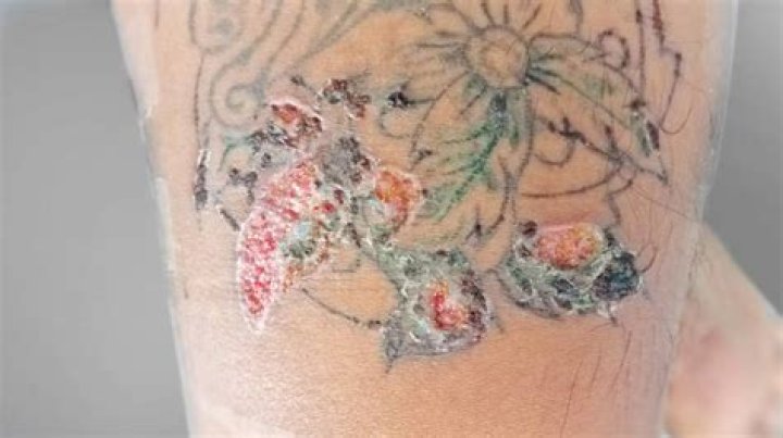 Why does my tattoo burn when I wash it?