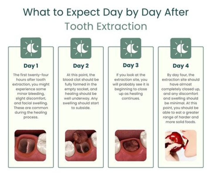 Why does my tooth extraction still hurt after 5 days?