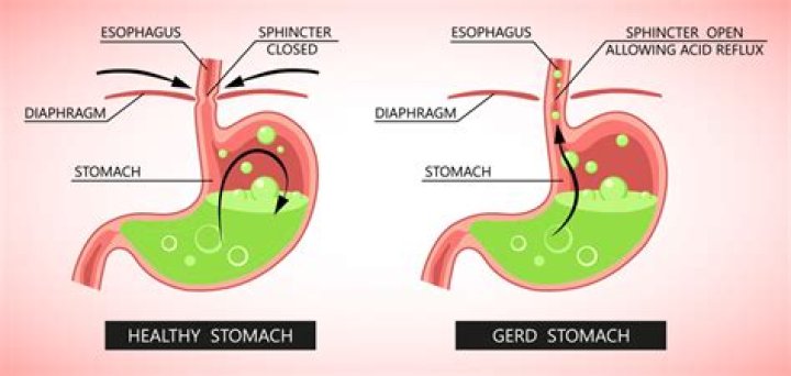 Why does your stomach drop on a plane?