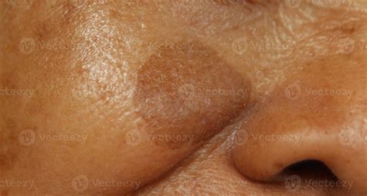 Why is it called Skins pure?