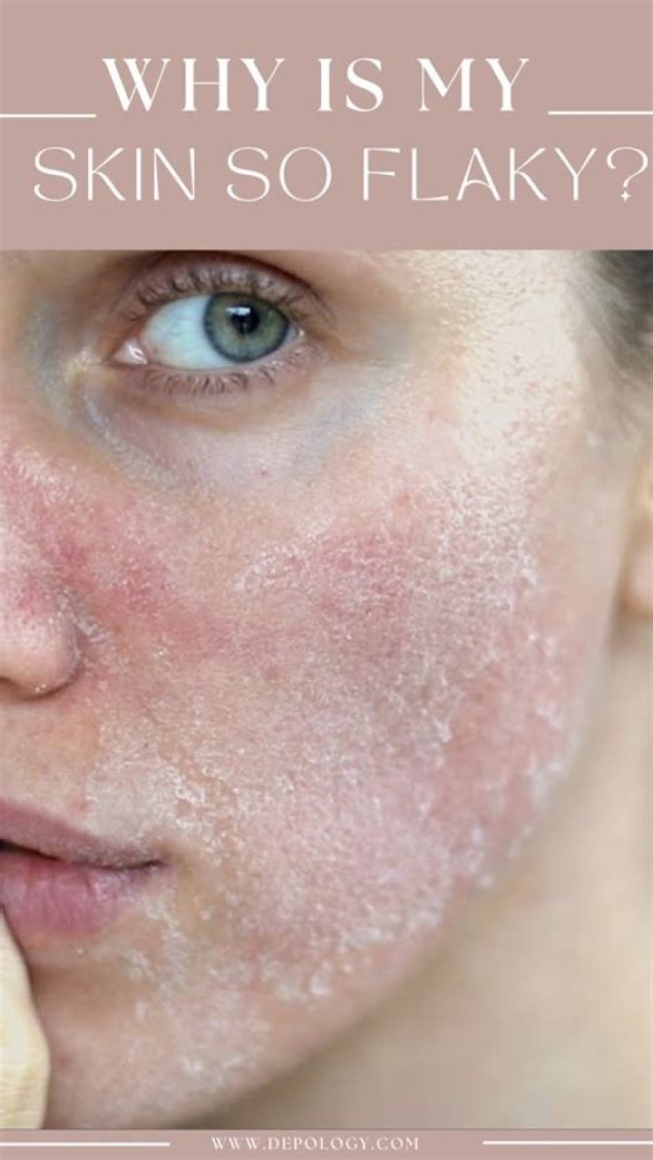 Why is my face so dry?