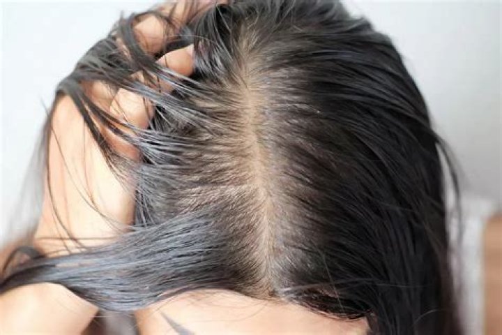 Why is my hair so oily?