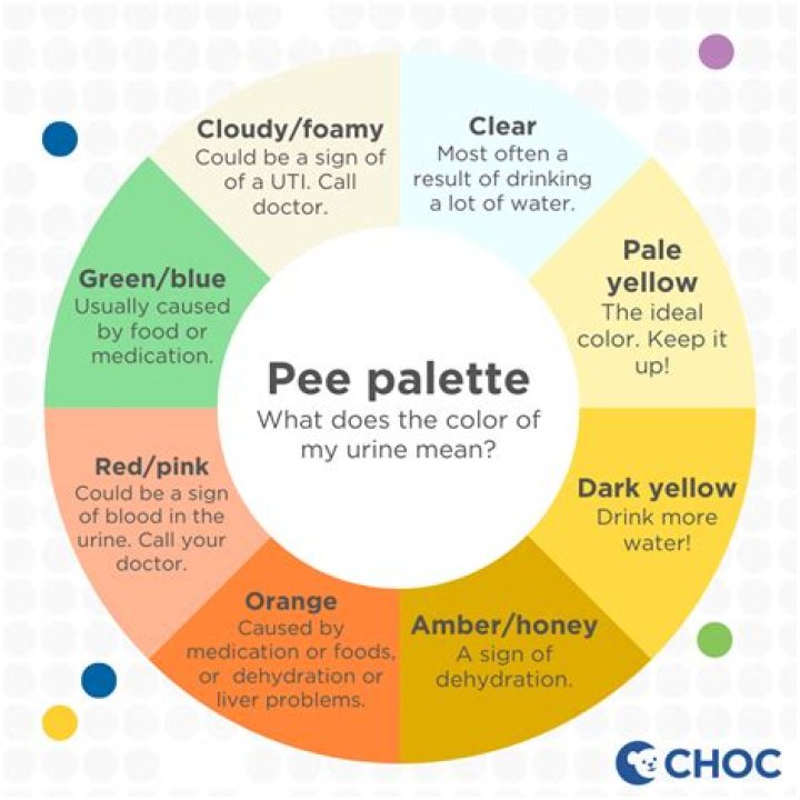 Why is my pee dark?