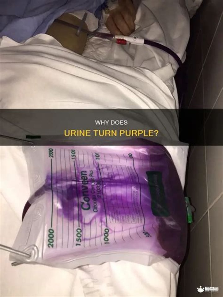 Why is my pee purple?