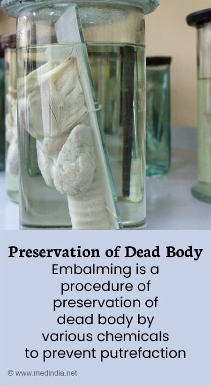Why is the body hard after embalming?