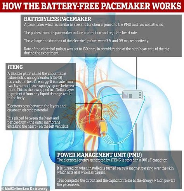 Will a pacemaker give me more energy?