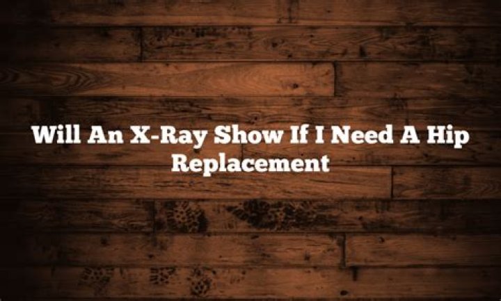 Will an xray show if I need a hip replacement?