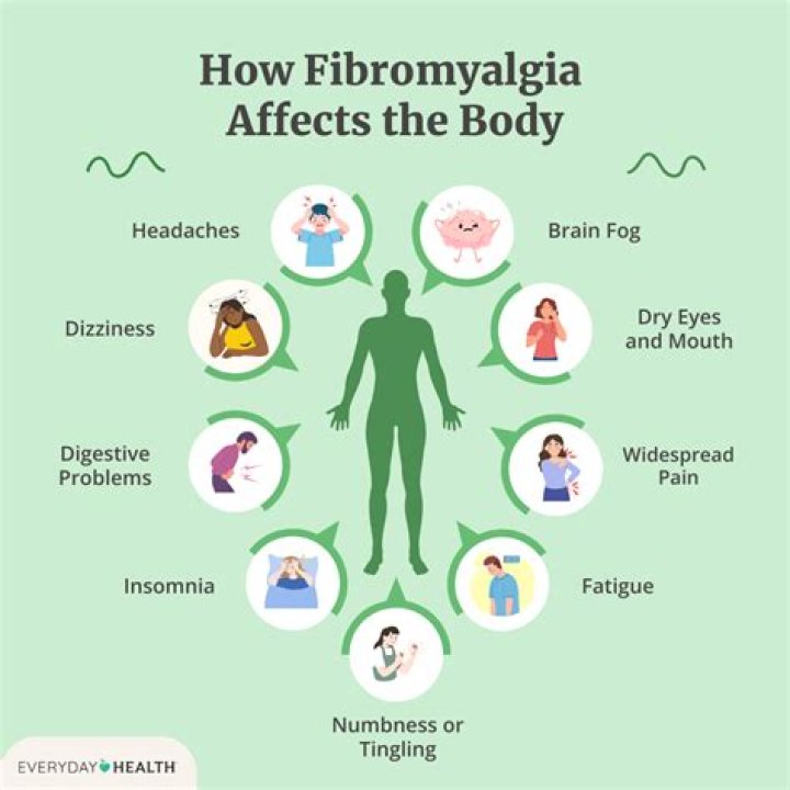 Will Ana be positive with fibromyalgia?