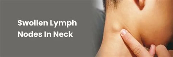 Will CT scan show swollen lymph nodes?