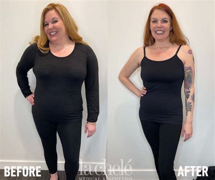 Will I lose weight after stopping Lexapro?